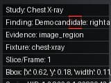 Synthetic non-clinical chest X-ray evidence fixture